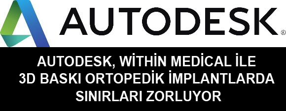 Autodesk, Within Medical ile 3D baskı ortopedik implantlarda sınırları zorluyor