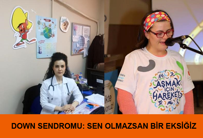 Down Sendromu: Sen Olmazsan Bir Eksiğiz